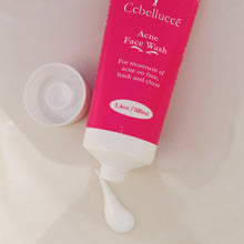 Load image into Gallery viewer, ACNE FACE WASH